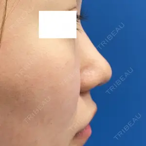 MIL CLINIC OSAKA 岩脇 槙佑医師の症例