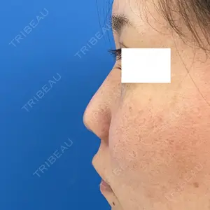 MIL CLINIC OSAKA 岩脇 槙佑医師の症例