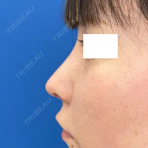 MIL CLINIC OSAKA 岩脇 槙佑医師の症例
