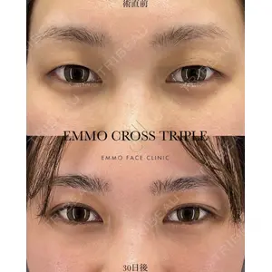 EMMO FACE CLINIC 大宮院 廣松 直樹医師の症例