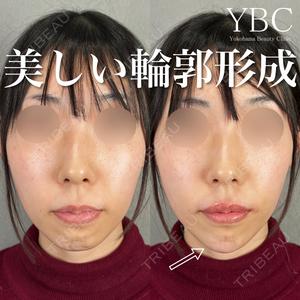 YBC横浜美容外科 池袋院 磯村 亮輔医師の症例
