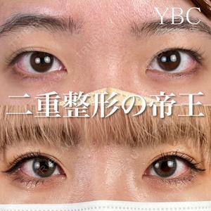 YBC横浜美容外科 池袋院 磯村 亮輔医師の症例