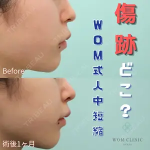 WOM CLINIC GINZA （ワム クリニック ギンザ） 佐々木 和司医師の症例