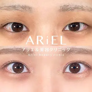 アリエル美容クリニック 大宮院 鈴木　桂介医師の症例