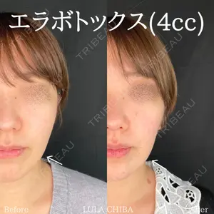 ルラ美容クリニック 千葉院 下川 洋輝医師の症例