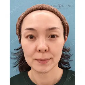エースクリニック 大阪梅田HEPナビオ院の症例