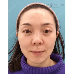 エースクリニック 大阪梅田HEPナビオ院の症例