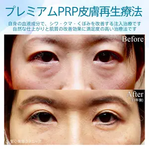 聖心美容クリニック 六本木院 伊藤 康平医師の症例