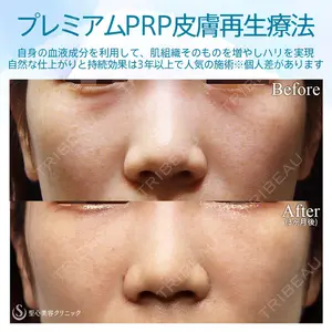 聖心美容クリニック 六本木院 菱田 健作医師の症例