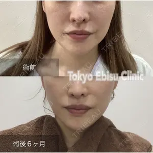 東京エビスクリニックの症例