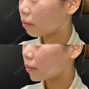 美容皮膚科エルムクリニック 岡山院の症例