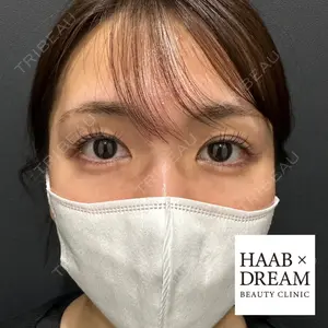 HAAB×DREAM BEAUTY CLINIC 東京本院 田中 優太医師の症例