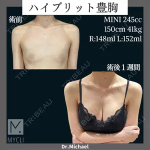 MYCLI【マイクリ】東京・恵比寿院 本田マイケル武史医師の症例
