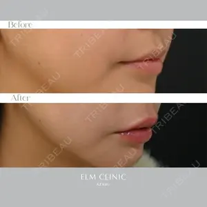 美容皮膚科エルムクリニック 福岡院の症例