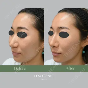 美容皮膚科エルムクリニック 福岡院の症例
