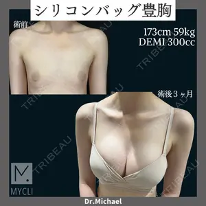 MYCLI【マイクリ】東京・恵比寿院 本田マイケル武史医師の症例