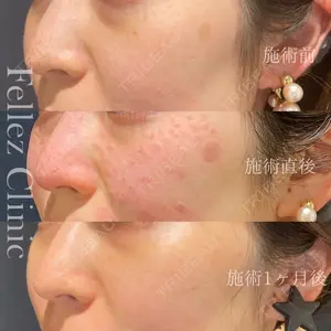 Fellez Clinic【フェルズクリニック】 小野 泰寛医師の症例