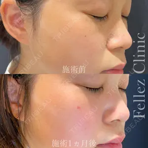 Fellez Clinic【フェルズクリニック】 小野 泰寛医師の症例