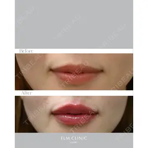 美容皮膚科エルムクリニック 福岡院の症例
