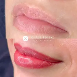 X CLINIC 福岡天神院 松岡　幸医師の症例