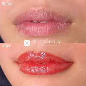 X CLINIC 福岡天神院 松岡　幸医師の症例