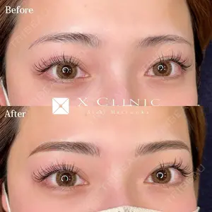 X CLINIC 福岡天神院 松岡　幸医師の症例