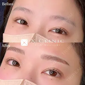X CLINIC 福岡天神院 松岡　幸医師の症例