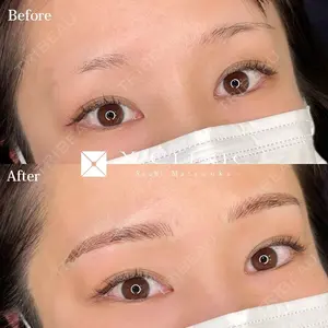 X CLINIC 福岡天神院 松岡　幸医師の症例