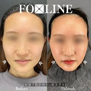 X CLINIC 銀座院 程 璐医師の症例