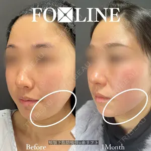 X CLINIC 銀座院 程 璐医師の症例