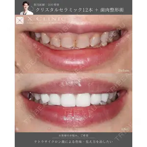 X CLINIC 銀座院 立川 惇里医師の症例