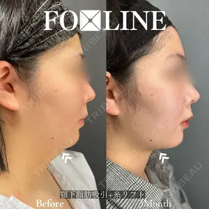 X CLINIC 銀座院 程 璐医師の症例