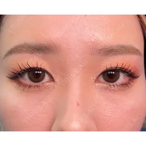 MIL CLINIC OSAKAの症例