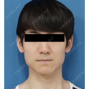 もとび美容外科クリニック 新宿院 西尾 謙三郎医師の症例