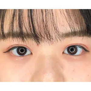 MIL CLINIC OSAKAの症例