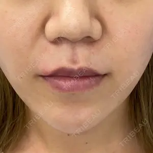 MIL CLINIC OSAKAの症例