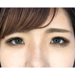 MIL CLINIC OSAKAの症例