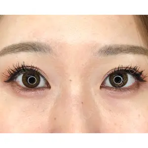MIL CLINIC OSAKAの症例