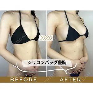 GAYA body design clinic 飯ヶ谷 重来医師の症例