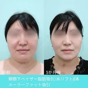 WOM CLINIC GINZA （ワム クリニック ギンザ） 深堀 純也医師の症例