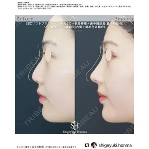 湘南美容クリニック 銀座院の症例