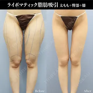 湘南美容クリニック 銀座院の症例