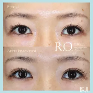 R.O.clinicの症例