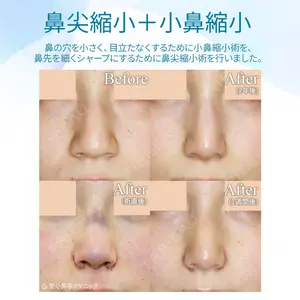 聖心美容クリニック 札幌院 前多 一彦医師の症例