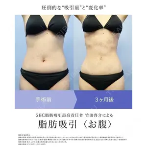 湘南美容クリニック 新橋銀座口院 竹田 啓介医師の症例