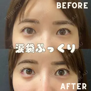 美容皮膚科エルムクリニック 福岡院の症例