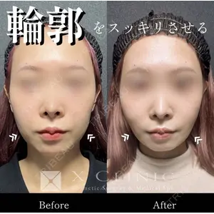 X CLINIC 恵比寿院の症例