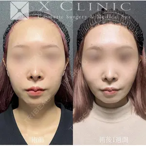 X CLINIC 恵比寿院の症例