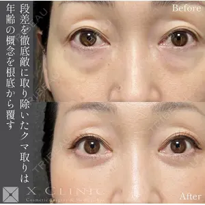 X CLINIC 恵比寿院の症例