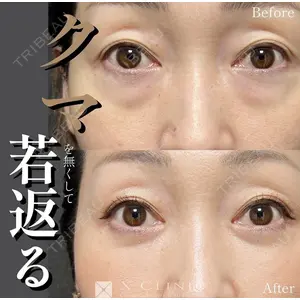 X CLINIC 恵比寿院の症例